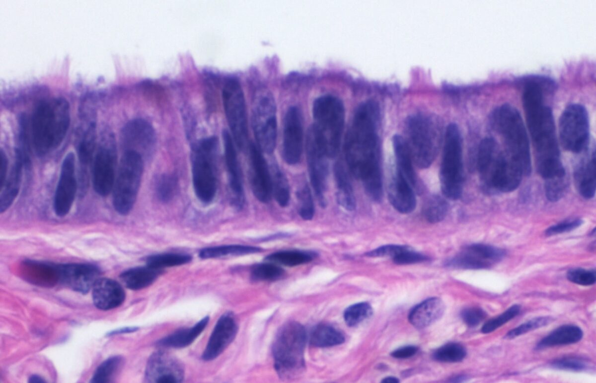 Epithelium of the fallopian tube