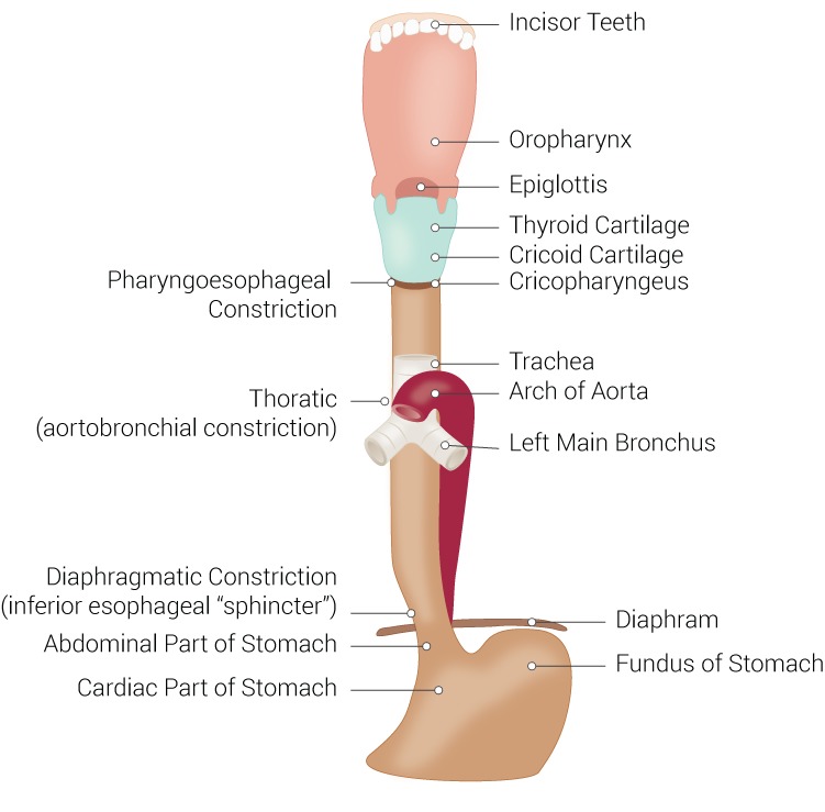 inflammation of the oesophagus