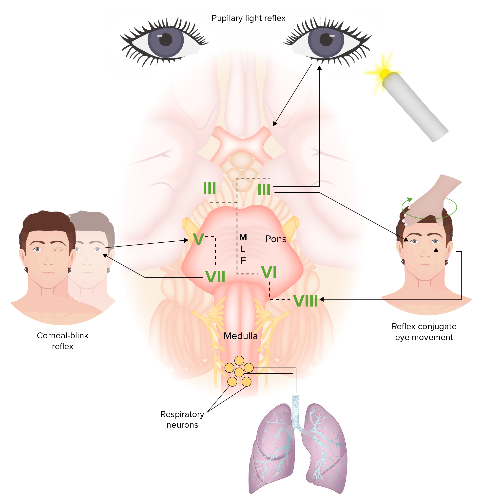 Toxic Shock Syndrome  Concise Medical Knowledge