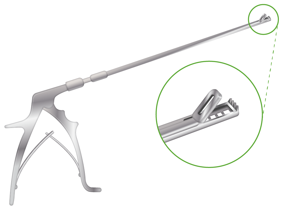 Example of a cervical biopsy forceps