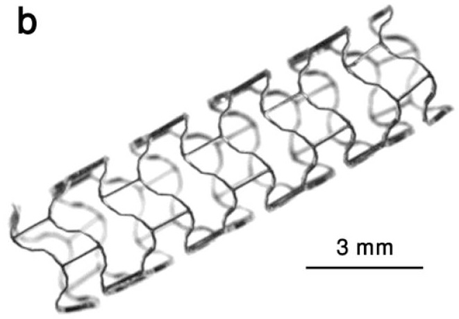 Example of a coronary stent, an expandable tubular metallic device