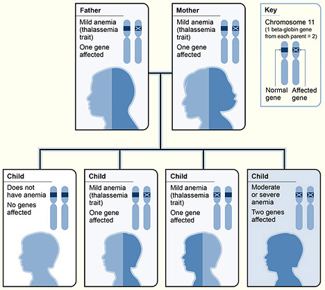 Example of beta thalassemia inheritance