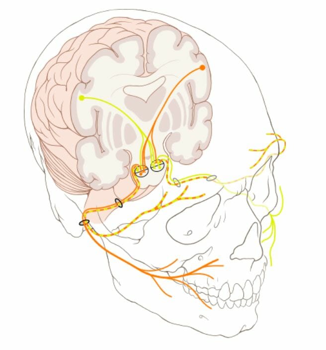 Núcleos del nervio facial en el tronco encefálico
