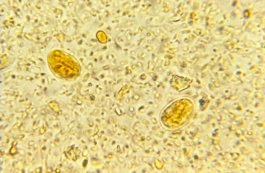 giardia in stool