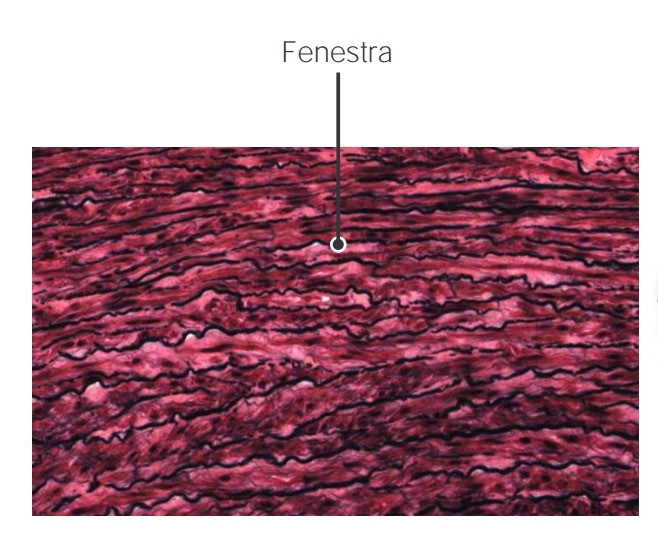 Fenestra (or windows) within the elastic fibers in the aortic wall
