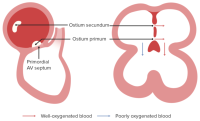 Development of the Heart | Concise Medical Knowledge