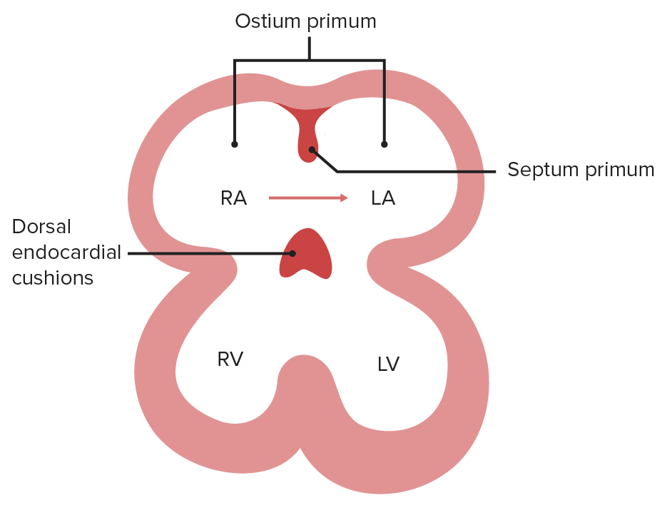 Foramen primum