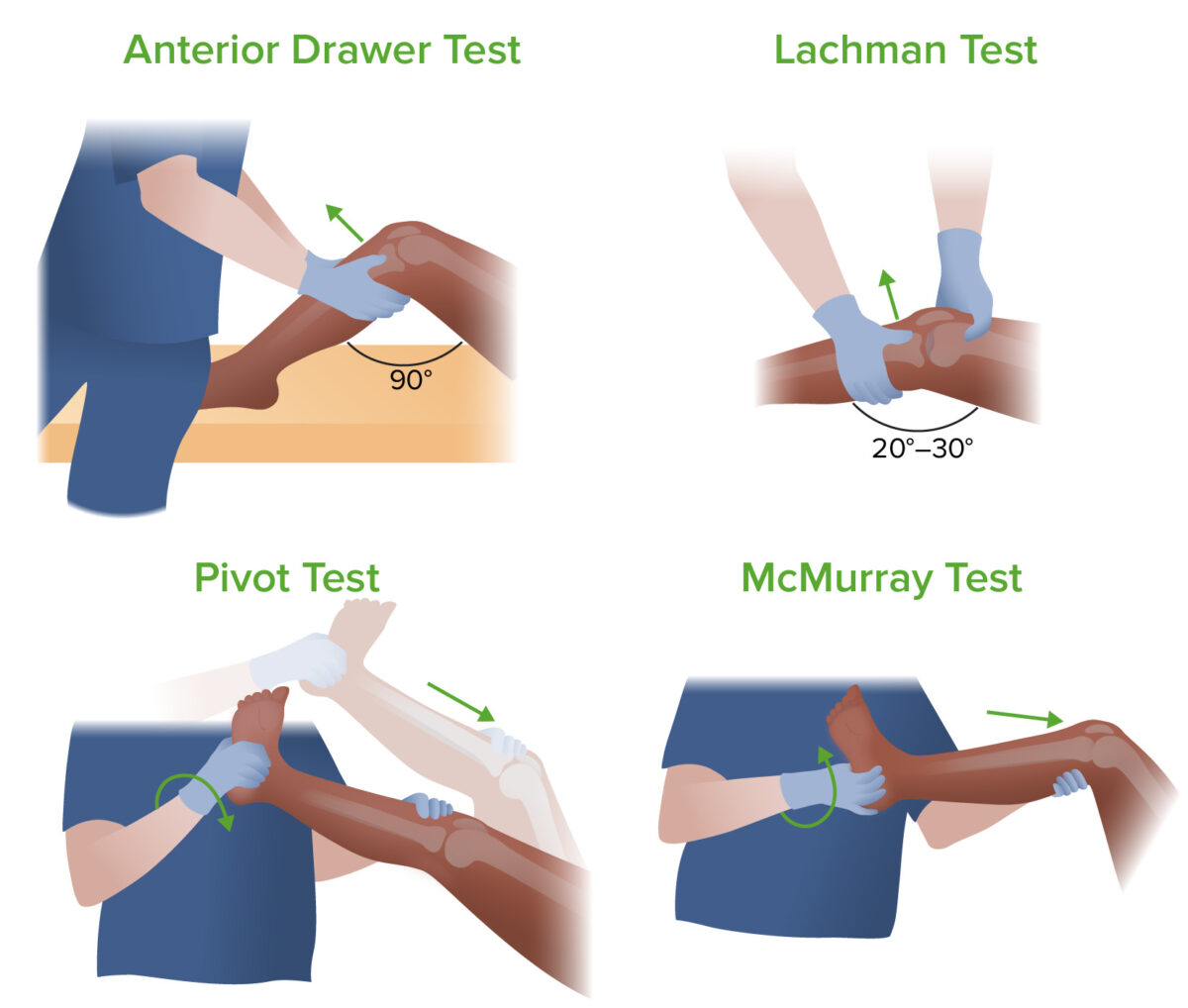 Cuatro exámenes utilizados para determinar la causa del dolor de rodilla.