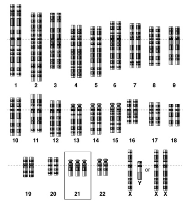 Genome schema of trisomy 21