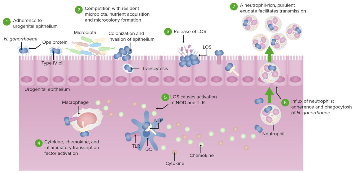 Compreendendo o Staphylococcus Aureus: Uma infecção bacteriana comum - GENE  MEIDIKE