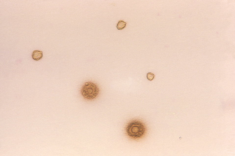 Gram-negative mycoplasma hominis