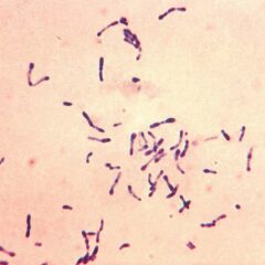 Gram-positive Corynebacterium diphtheriae bacteria