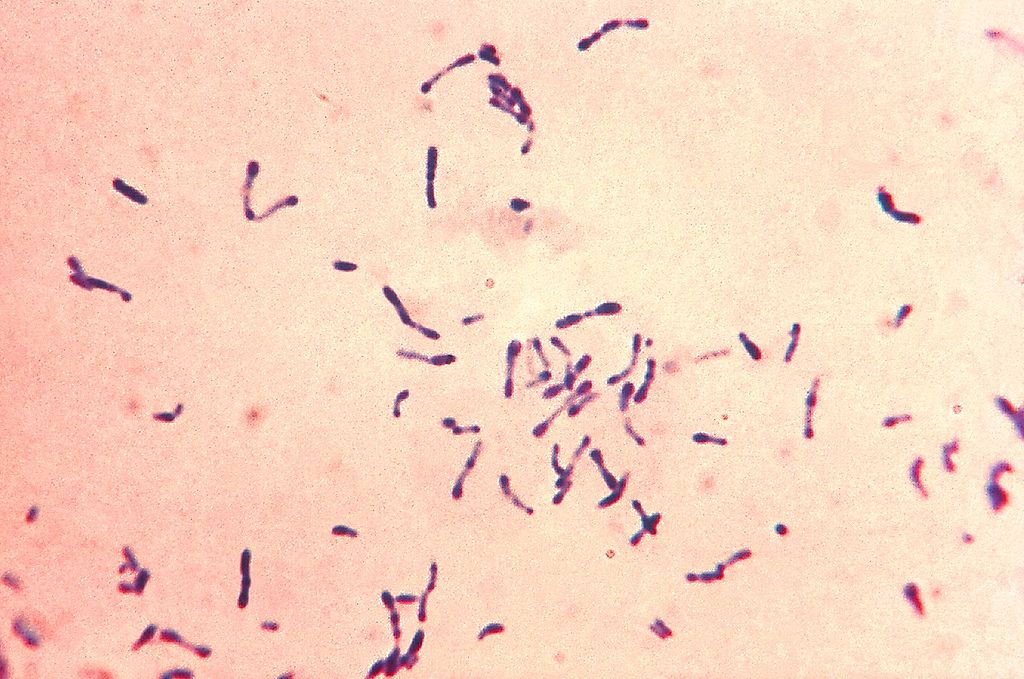 Gram-positive corynebacterium diphtheriae bacteria