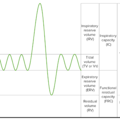 Graphical representation of lung volumes as measured by body plethysmography