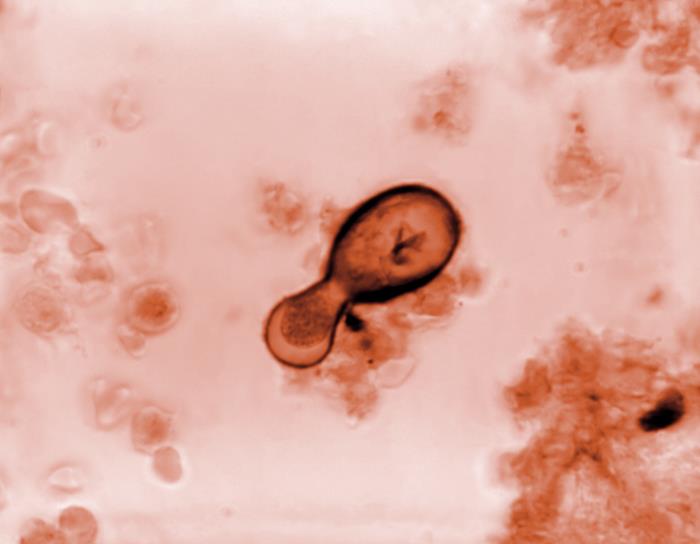 Gridley-stained congolese tissue sample of blastomyces