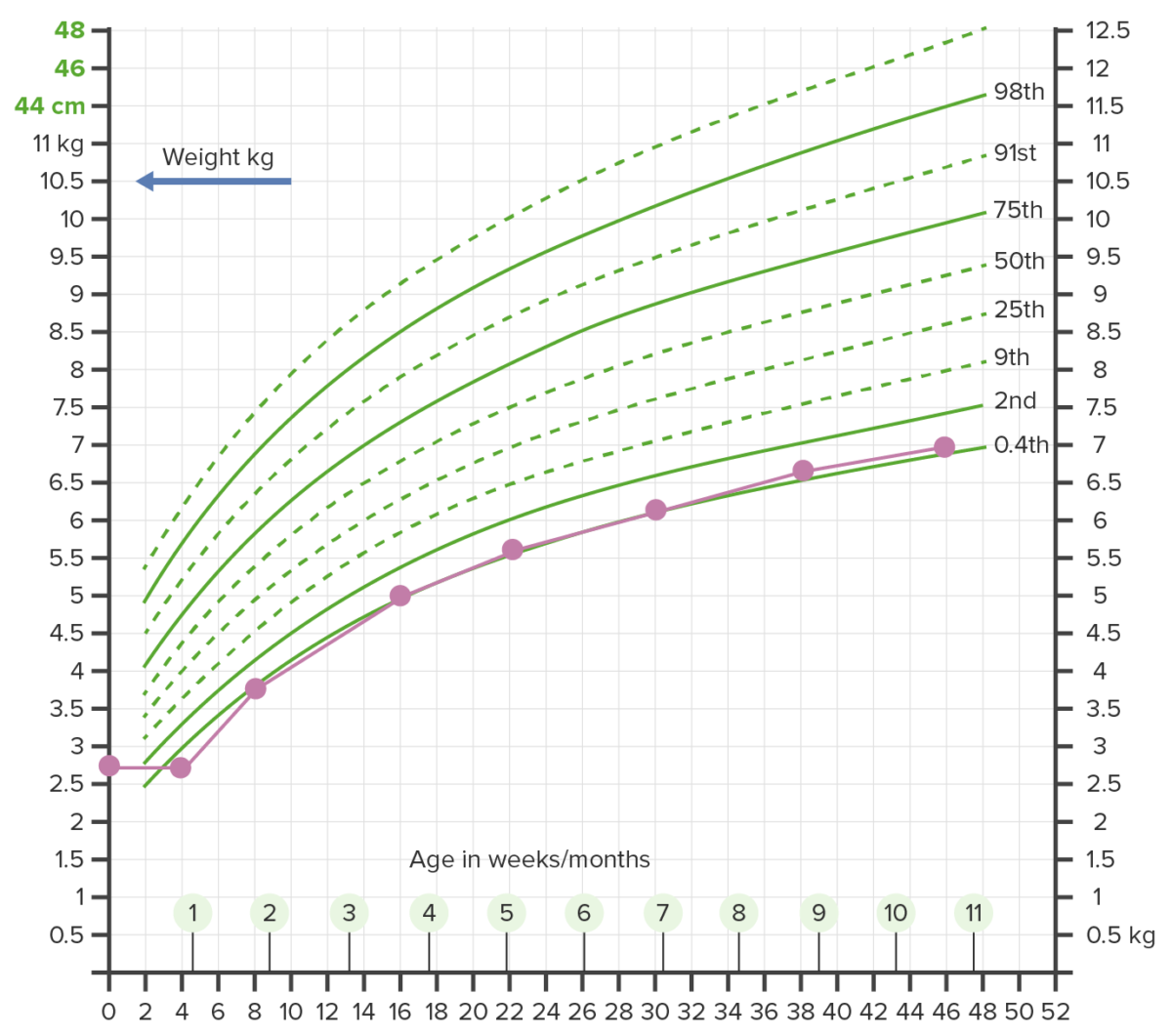 Gráfico de crescimento de mpep