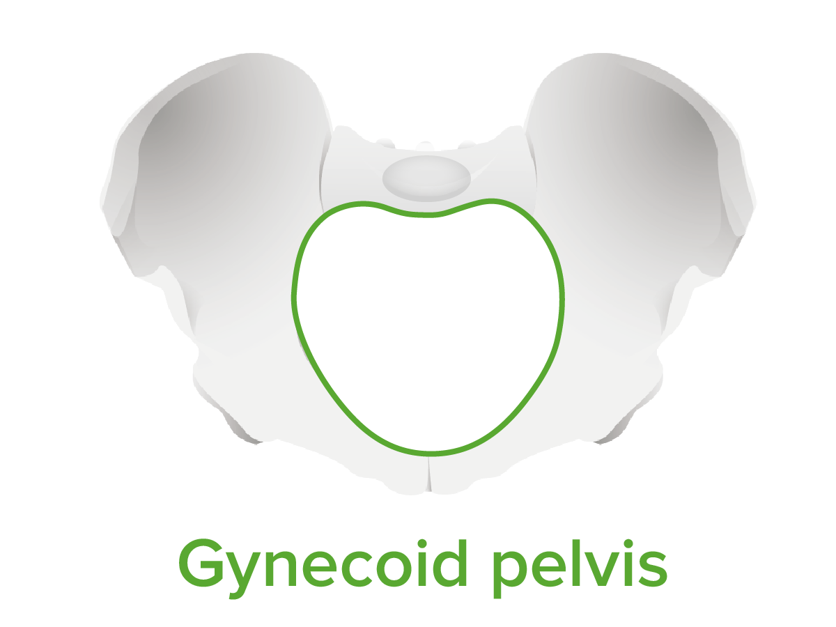 Gynecoid pelvis