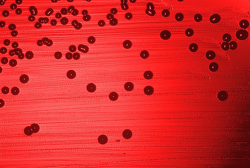 Haemophilus influenzae on blood agar