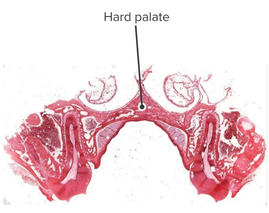 Hard palate and its relations with the nasal and oral cavities