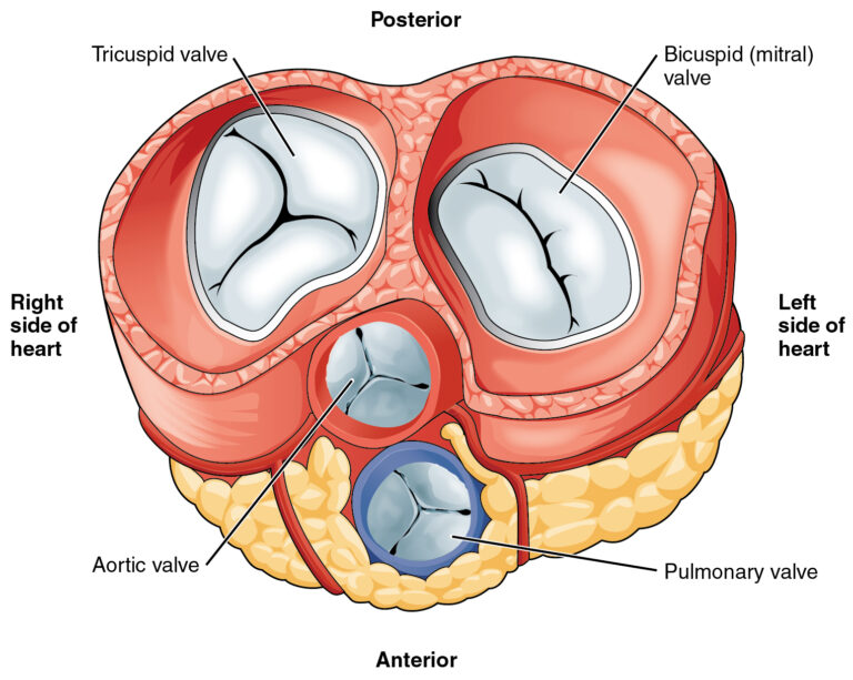 Estenosis Pulmonar Concise Medical Knowledge