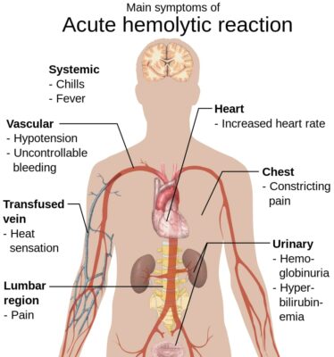 Hemolytic reaction symptoms