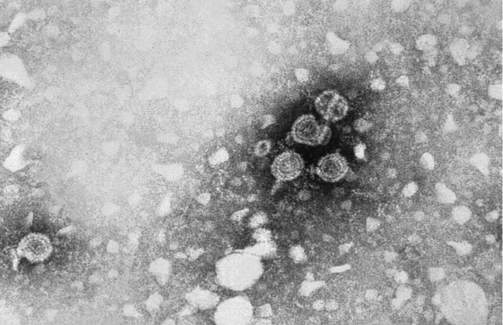 Hepatitis b virus (hbv) particles