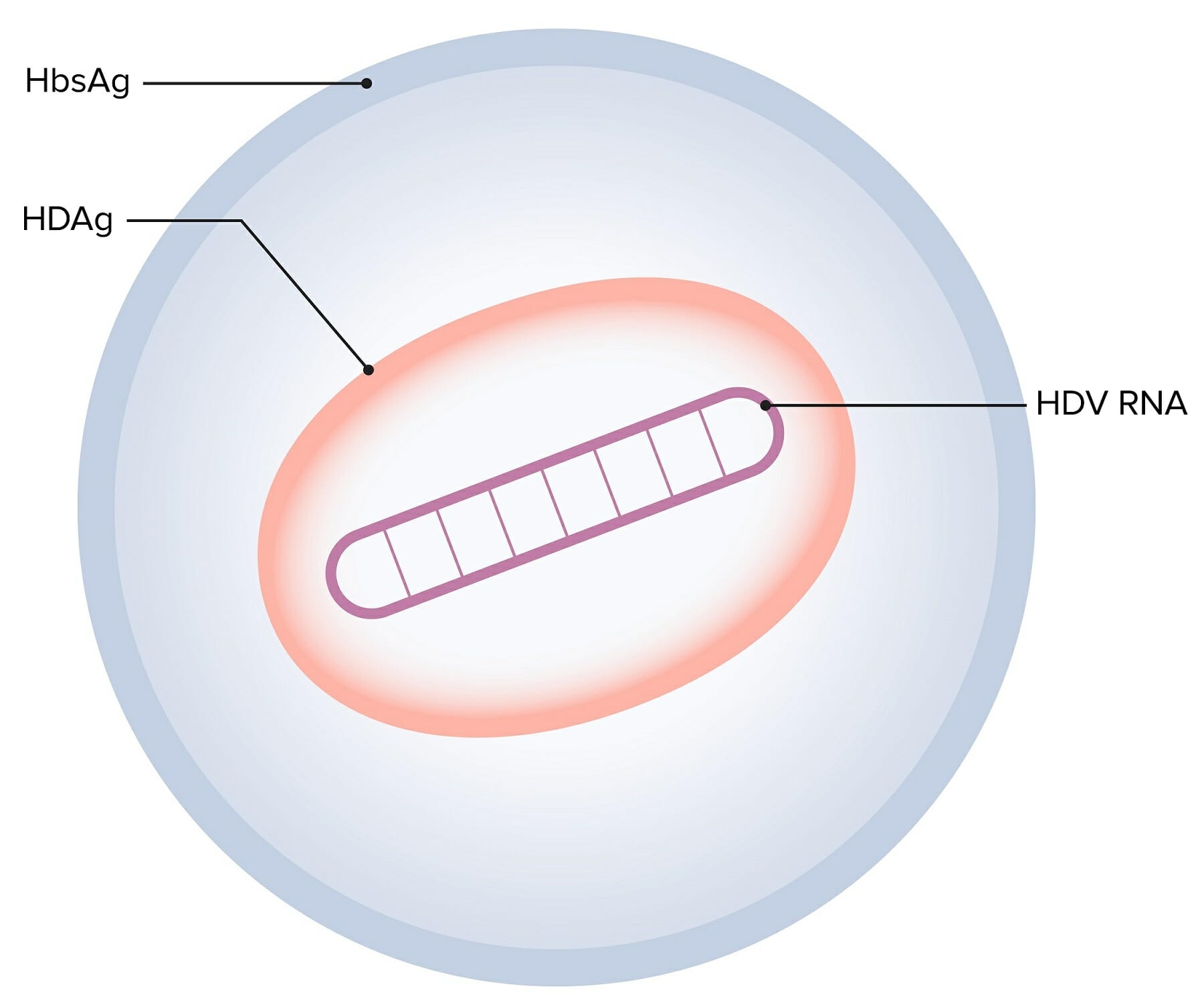 HBc-based virus-like particle assembly from inclusion bodies using