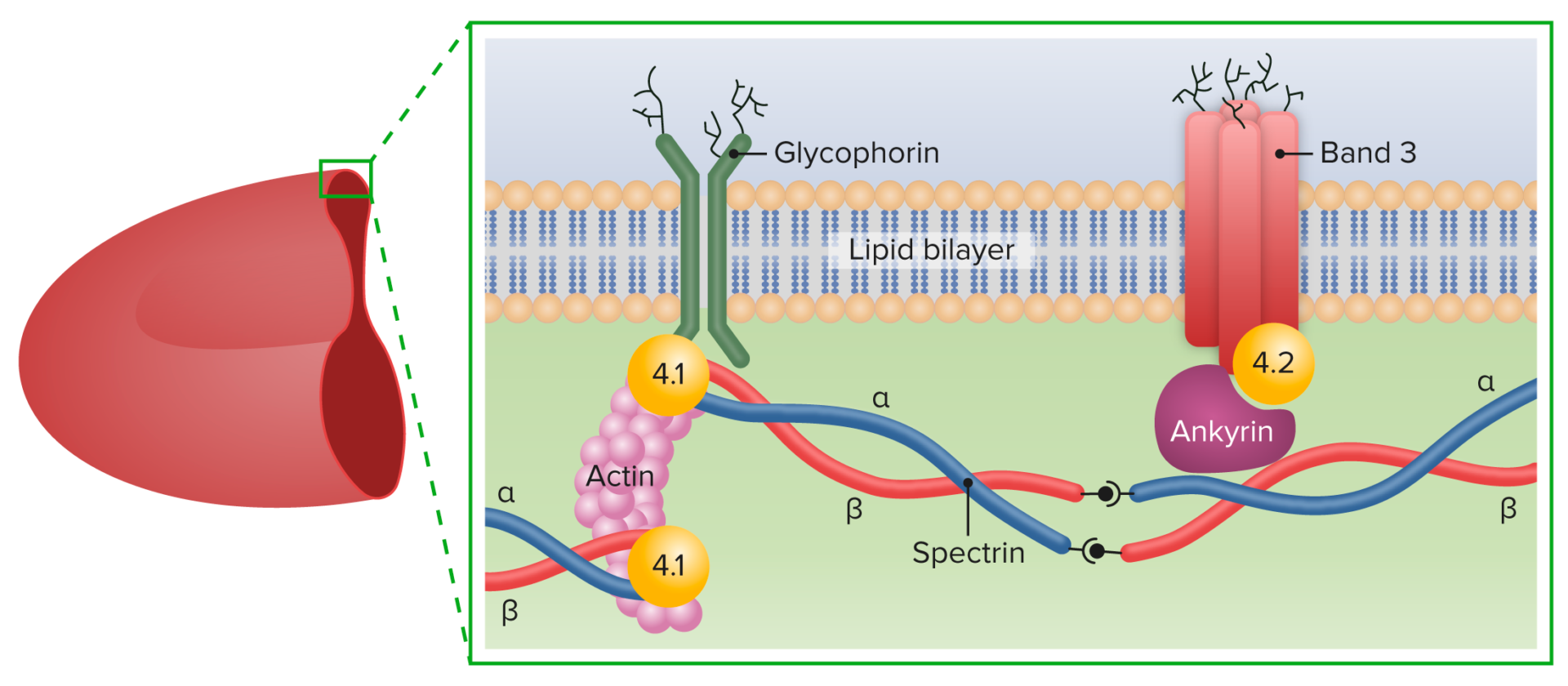 Hereditary Spherocytosis Concise Medical Knowledge