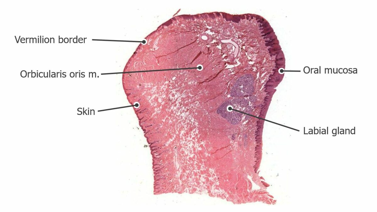 Histologic cross section of the lip