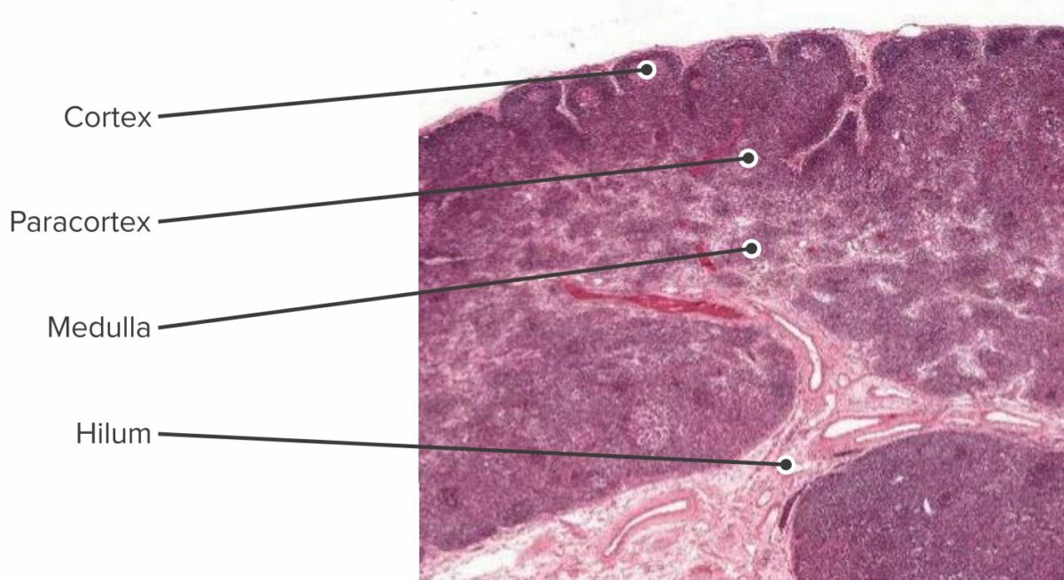 Histologic section of the lymph node showing the cortex, paracortex and the medulla