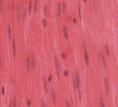 Histologic slide shows smooth muscle that contains a centrally located oval nucleus