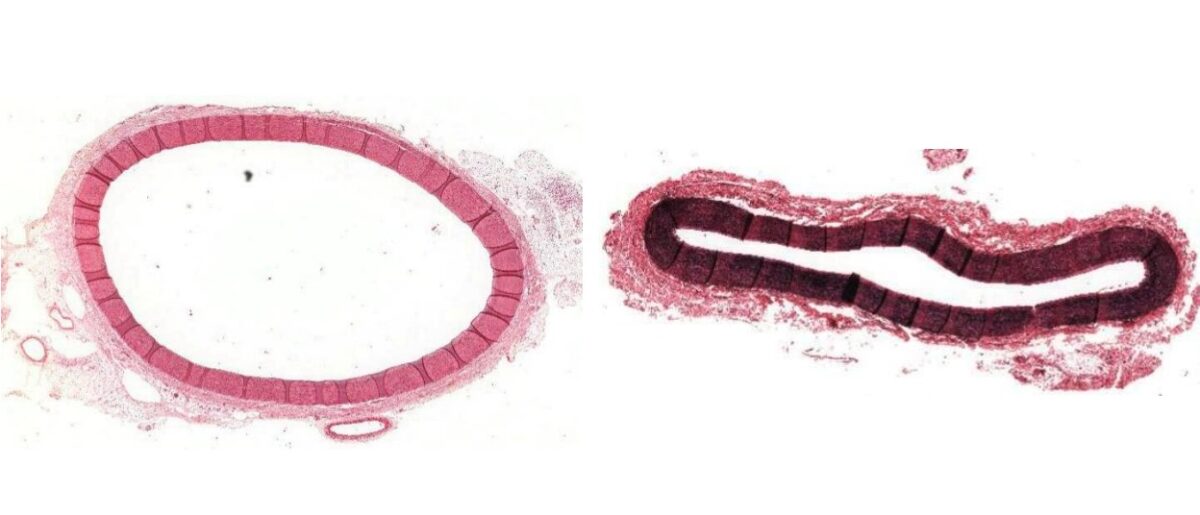 Histologic staining of the aorta