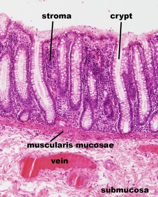 Histological image of the rectal mucosa (longitudinal section)