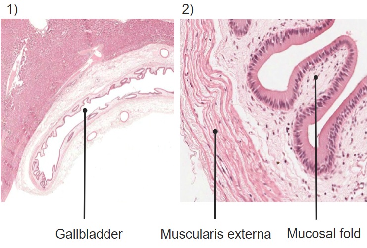 Lâmina histológica mostrando a vesícula biliar e as pregas mucosas