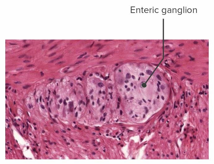Histology image of an enteric ganglion