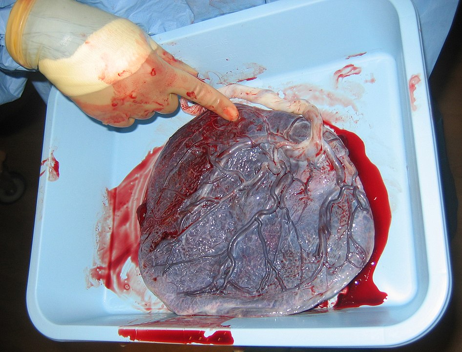 Human placenta shown a few minutes after birth