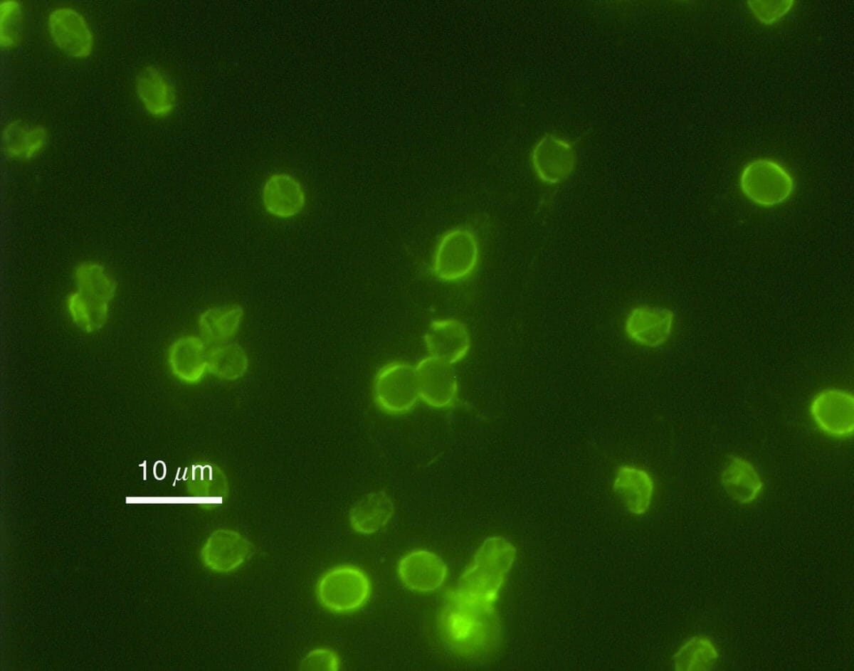 Inmunofluorescencia de ooquistes de cryptosporidium parvum de ooquistes de cryptosporidium parvum