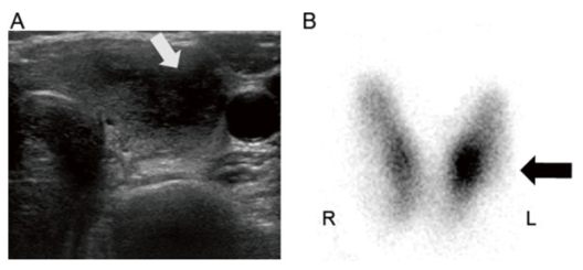 Initial thyroid ultrasound scanning