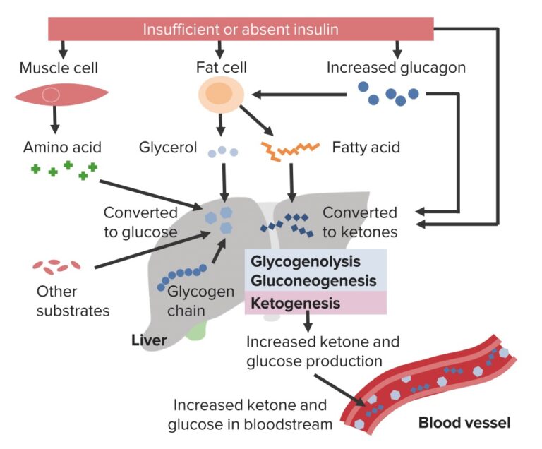 Hyperglycemic Crises | Concise Medical Knowledge