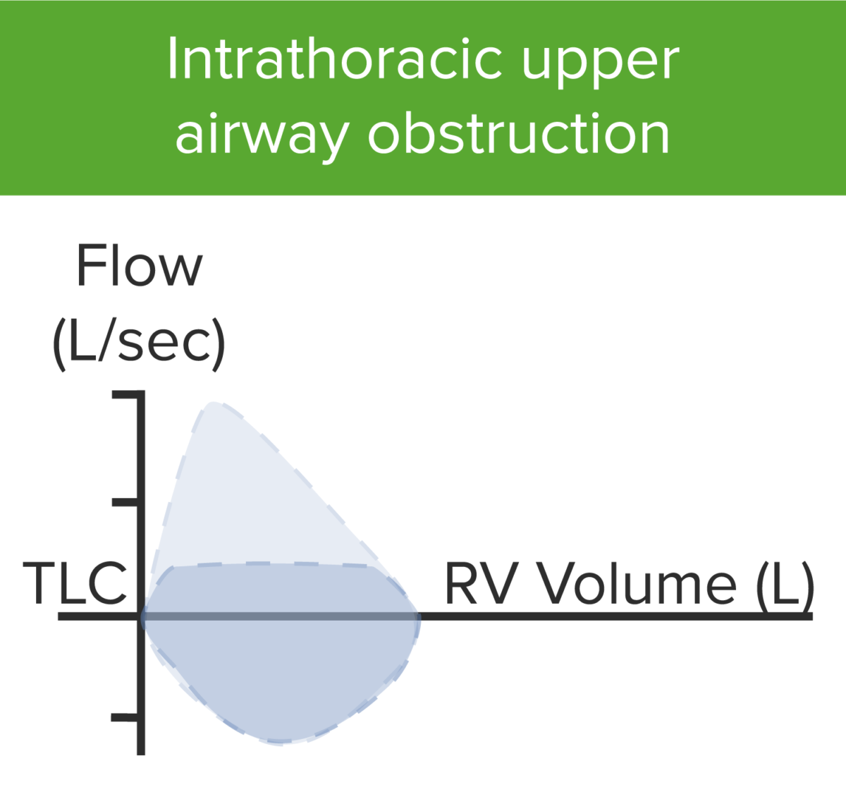 Intrathoracic upper airway obstruction uao 2