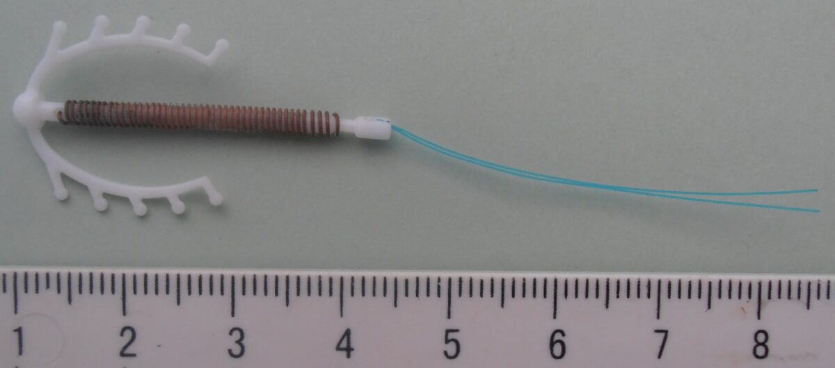 copper intrauterine device