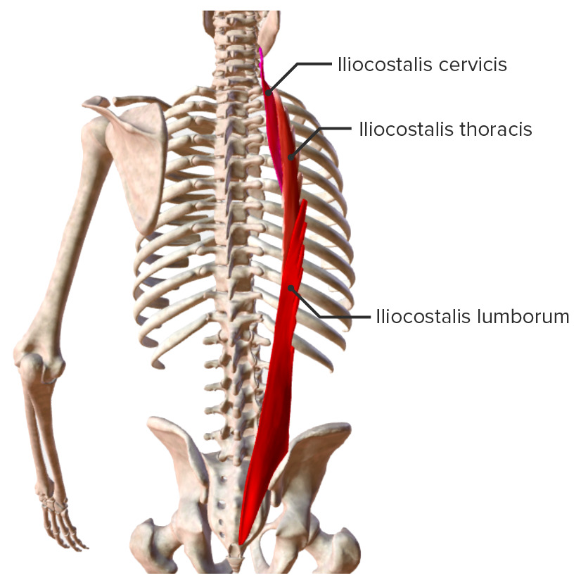 Intrinsic back muscles iliocostalis muscle group