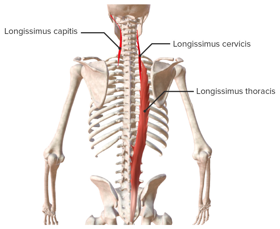 Intrinsic back muscles longissimus muscle group biodigital