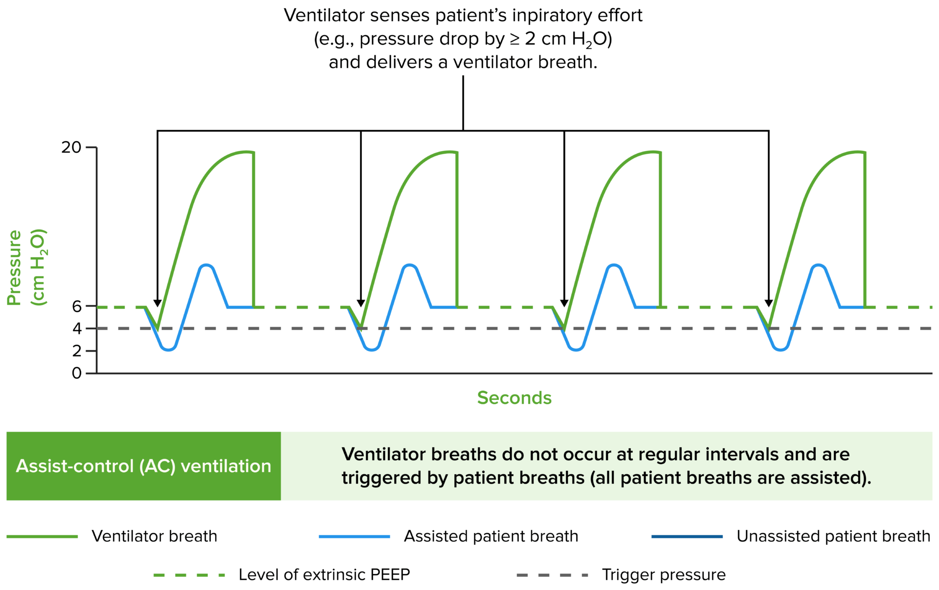 ventila-o-mec-nica-invasiva-concise-medical-knowledge