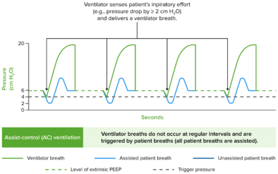 Invasive Mechanical Ventilation | Concise Medical Knowledge