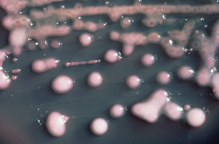 K. Pneumoniae forming pink colonies on macconkey agar
