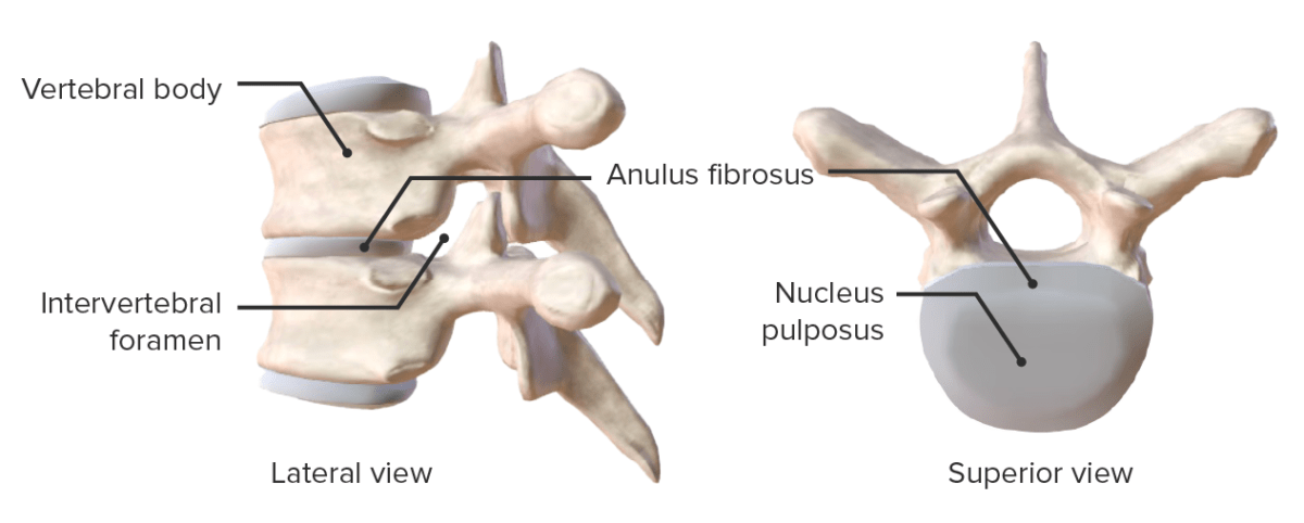 Lateral and superior view showing the components of the intervertebral disc