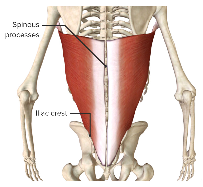Músculo dorsal ancho