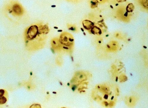 Legionella silver stain