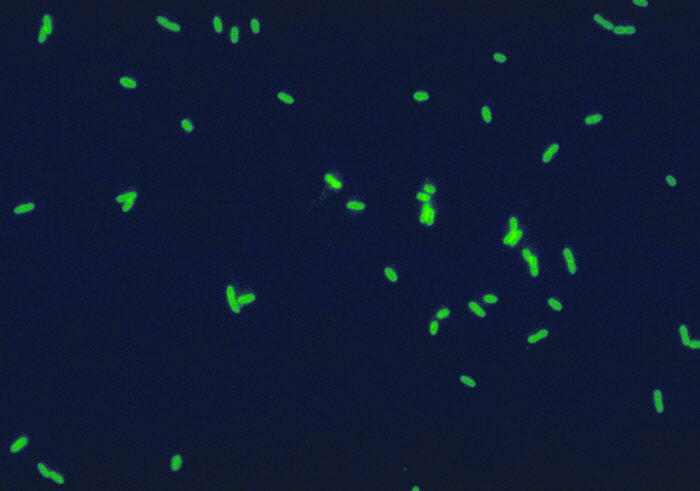 Legionella pneumophila immunfluoreszenz-färbung